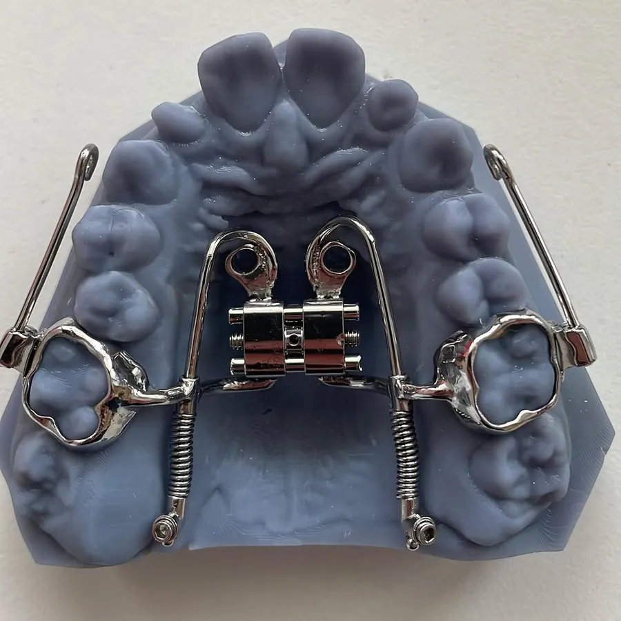 Disjunctor cu arcuri pe model dentar printat