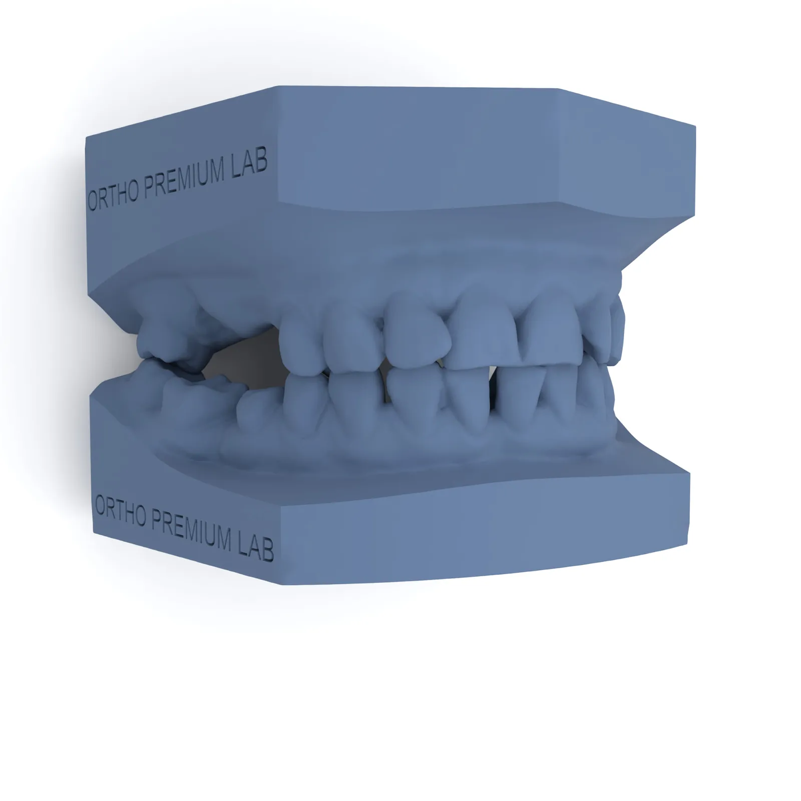 Model de studiu dentar printat 3D